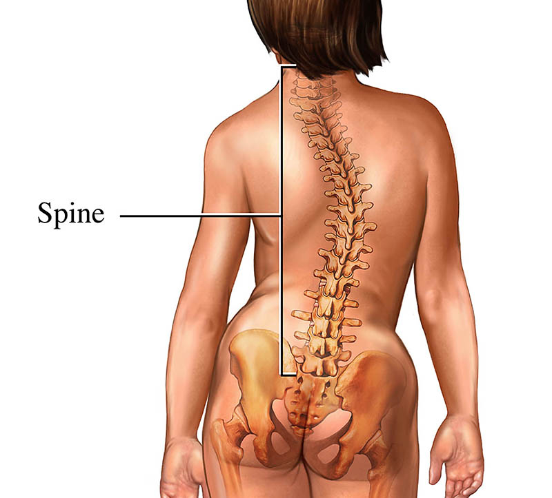scoliosis with muscle imbalance